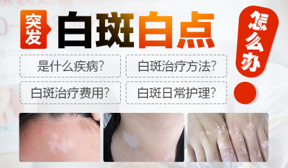 廣州308激光治療白癜風